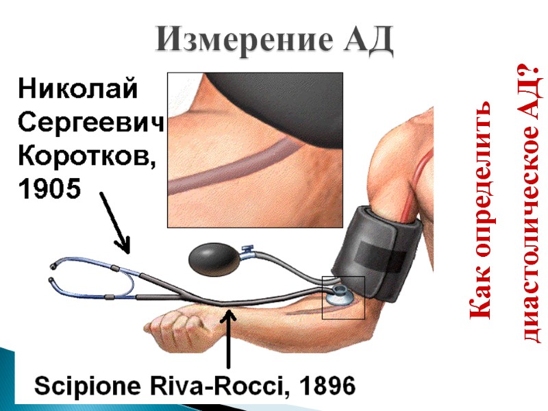 Измерение АД Как определить   диастолическое АД?